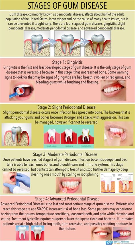 Periodontal / Gum Disease Treatment .
